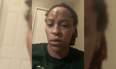 Vicksburg Woman alleges assault by police officer following arrest